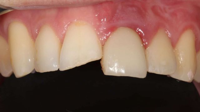 ANTES CIRUGIA BUCAL